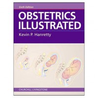 OBSTETRICS ILLUSTRATED (EDISI 6)